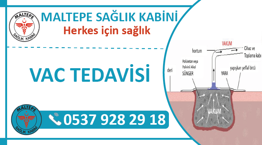 VAC Tedavisi, TOPİVAC, Negatif Basınç VAC, Vakum Yardımlı Yara Tedavisi