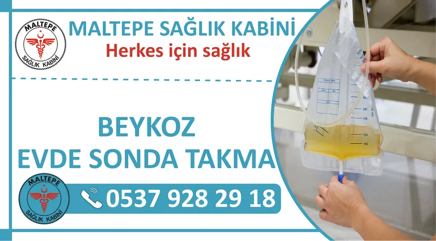 Beykoz Evde Sonda Takma Hizmeti