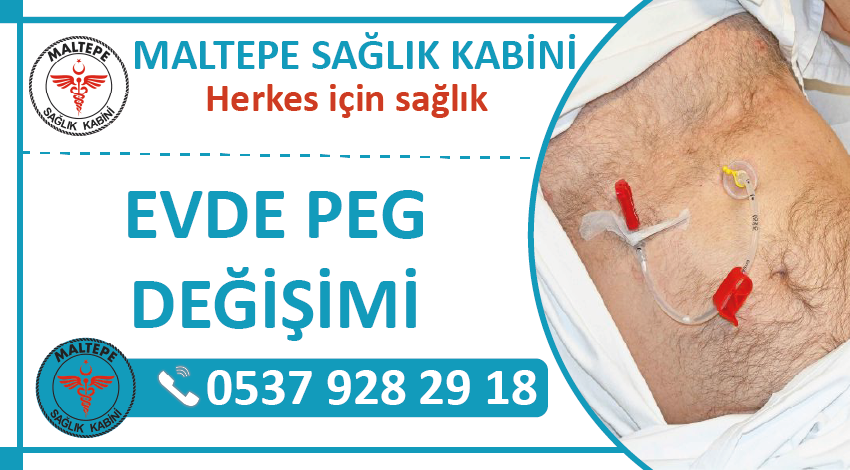 Evde PEG Değişimi ve Evde PEG Hortumu Değişimi - PEG Değişim Fiyatları